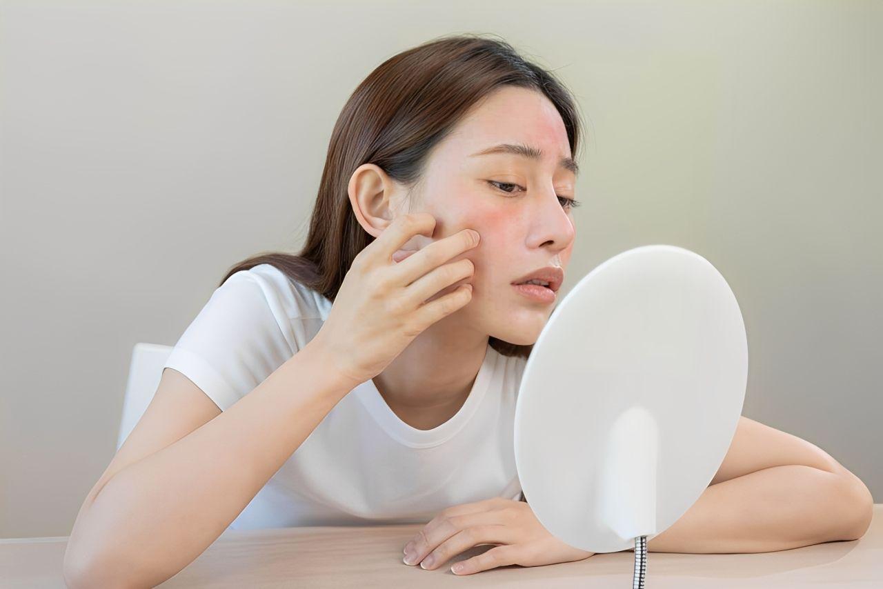 Các dấu hiệu nhận biết dị ứng sữa rửa mặt bạn cần biết