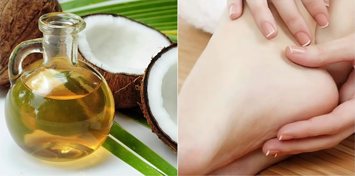 Cách trị nứt gót chân bằng dầu dừa đơn giản & hiệu quả tại nhà