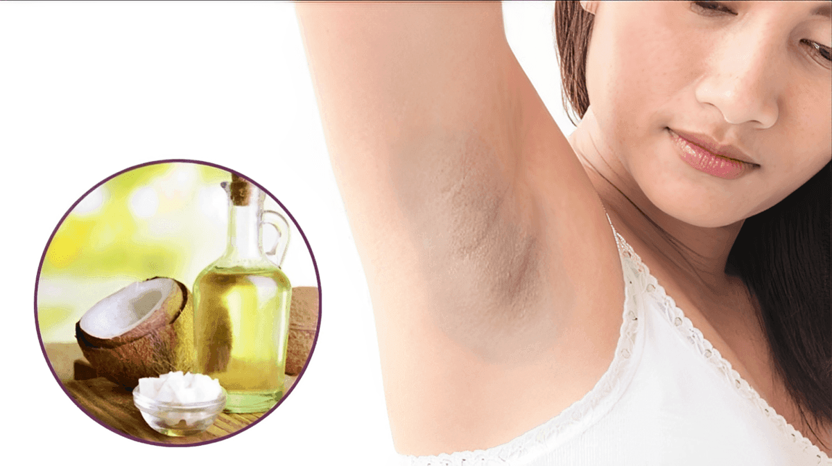 Dầu dừa có trị thâm nách không? Hướng dẫn 5 công thức tại nhà