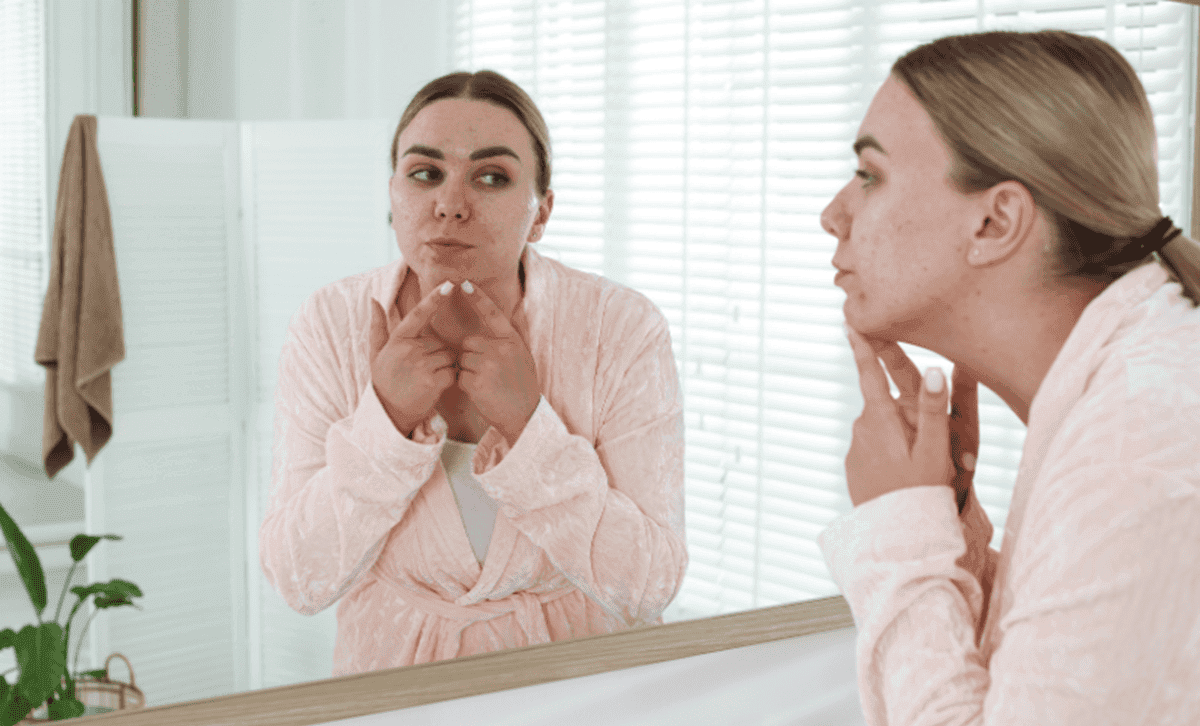 Các bước skincare da mụn đúng cách giúp giảm mụn, ngừa thâm 