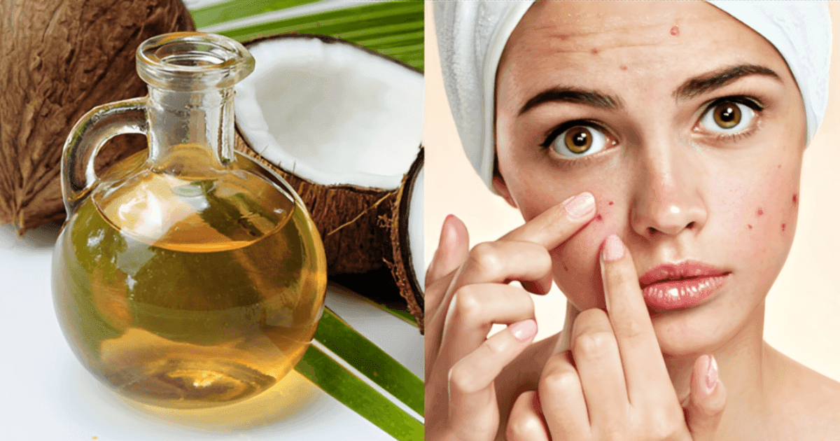 Bôi dầu dừa bị ngứa thì cần phải làm gì? [Hướng dẫn cách xử lý]