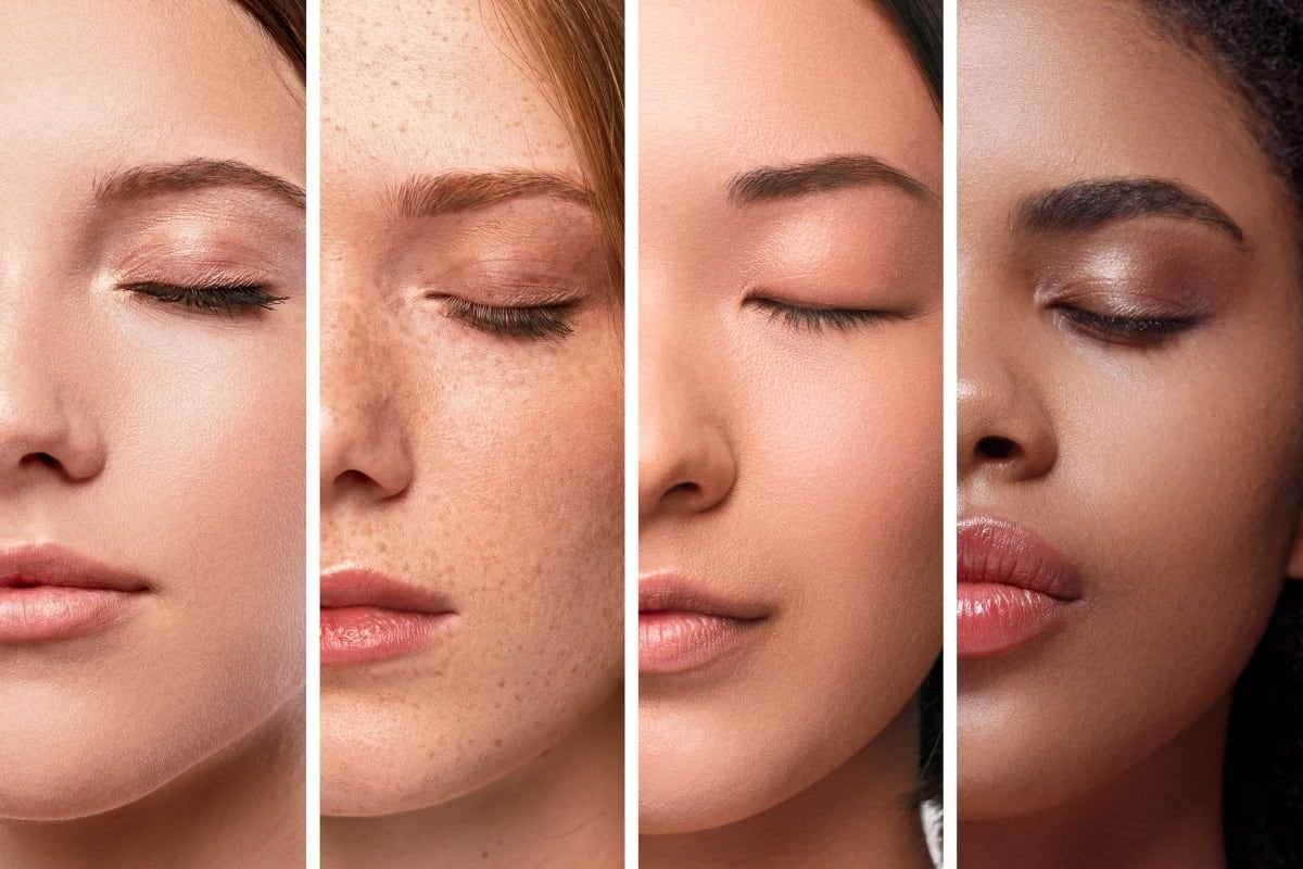 các loại da ảnh đại diện