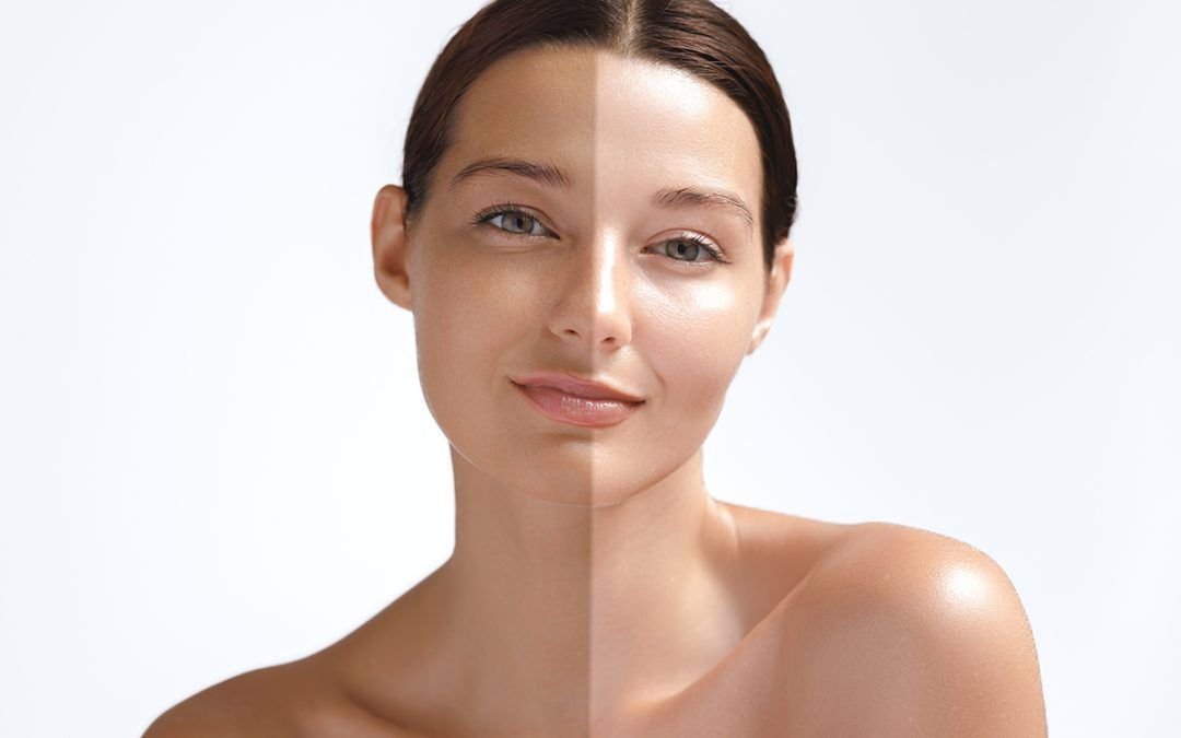 Làm gì để da trắng hồng tự nhiên? Bí quyết đơn giản ngay tại nhà