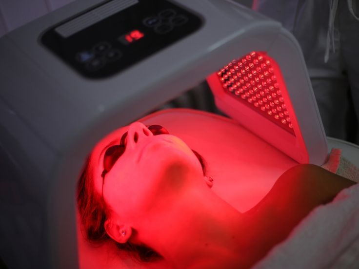 Liệu pháp ánh sáng LED trị mụn: Hiệu quả thực sự?